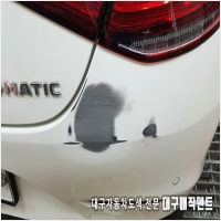 지산매직덴트 PC 갤러리 12