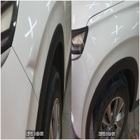 지산매직덴트 PC 갤러리 3