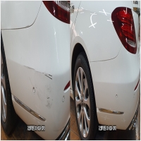 지산매직덴트 PC 갤러리 10